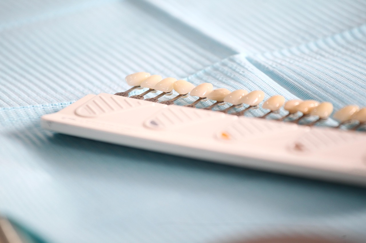 Stomatologia estetyczna – kiedy warto rozważyć wybielanie zębów i licówki